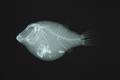 Canthigaster amboinensis (x-ray)