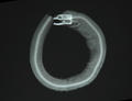 Gymnothorax melatremus (x-ray)